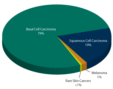 skin-cancer-incidence-pie-chart